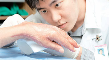 화상으로 피부 근육이 오그라든 손을 성형수술한 환자를 상대로 의료진이 수술 부위를 소독하고 있다. 사진 제공 한림대 한강성심병원