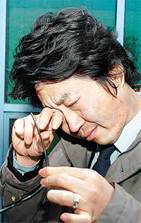 아데노바이러스로 눈병에 걸린 한 남성이 심한 통증 때문에 눈을 비비고 있다. 대개1, 2주 안에 좋아지지만 심하면 눈의 혼탁 증상이 올 수 있다. 동아일보 자료 사진