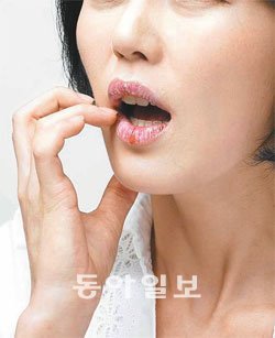 한 회사원이 부르튼 입술을 손으로 만지고 있다. 입술은 춥고 건조한 날씨에 거칠어지기 쉽다. 평소 유분과 수분을 유지해줘야 하며, 물집이 생기면 피부과에서 전문 의약품을 처방받아야 한다. 사진 제공 바이엘헬스케어