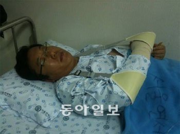 22일 화재현장에서 시민들을 구하다 다친 남기형 씨가 병원에서 수술을 받은 뒤 누워 있다. 박재명 기자 jmpark@donga.com