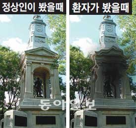 황반변성 환자는 사물의 가운데가 잘 보이지 않고 직선이 물결치듯 보인다(오른쪽). 동아일보DB