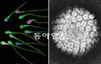 국내 연구진의 5년간의 연구 끝에, 정액 속 물질이 자궁경부암 예방에도 효과가 있다는 결과가 나왔다. 오른쪽 사진은 자궁경부암을 일으키는 인유두종 바이러스(HPV). 동아일보DB
