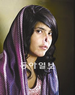 대상 ‘코 잘린 아프간 여인’ 2010