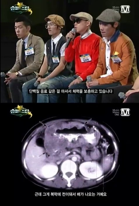 위암 투병을 고백한 ‘울랄라세션’의 임윤택(사진= 방송캡쳐)