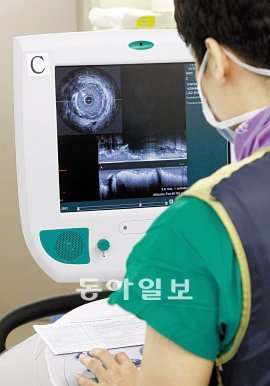 스텐트에 달린 내시경을 통해 환자의 혈관 내부를 관찰하고 있다. 홍진환 기자 jean@donga.com