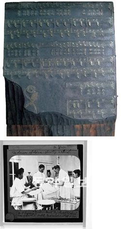 1933년 금속과 나무로 만든 홍난파의 동요 악보 원판(위)과 1904년 의사 에비슨의 수술 장면을 담은 유리 건판 필름. 문화재청 제공