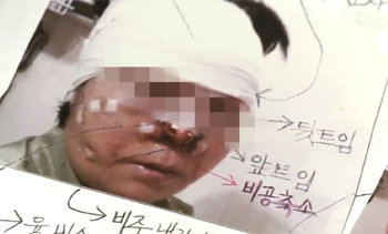 채널A 뉴스 ‘뉴스A’ 방송화면 캡쳐.