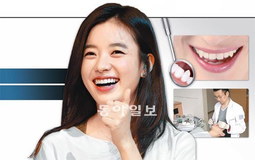 건치미인 한효주의 자신 있는 미소. 이런 미소를 갖고 싶지만 덧니 때문에 고민하는 사람이 많다. 자칫 마음의 병이 되기 쉬운 덧니를 방치하지 말고 어린시절 제대로 교정하는 것이 좋다. 동아일보 DB