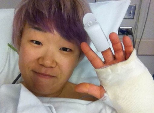 신지애가 손목 내 뼛조각 제거 수술을 받았다. 수술 후 손목과 손가락에 붕대를 감고 있는 신지애. 사진제공 ｜ 세마스포츠마케팅