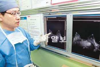 윤을식 고려대 안암병원 교수가 유방 재건 수술을 앞두고 환자의 상태를 MRI영상으로 살펴보고 있다.