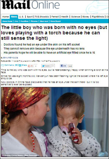눈 없는 아기의 안타까운 사연이 소개돼 화제가 되고 있다.