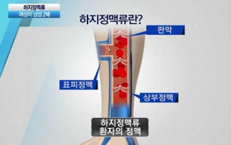 채널A ‘뉴스A’ 방송화면 캡쳐.