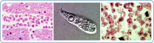 ‘네글레리아 파울러리(Naegleria fowleri)’. [사진 출처 : 미국 질병통제예방센터(CDC)]