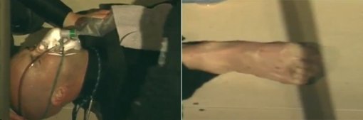 공연 중 범고래 공격을 받은 조련사 켄 피터스.