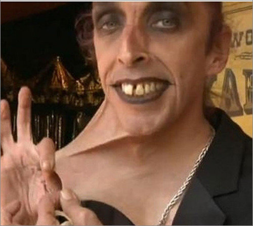 ‘고무 피부 男’으로 불리는 게리 터너 씨. (사진= 데일리메일 캡처)