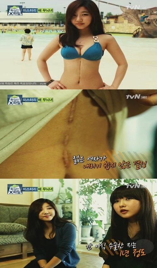 화성인 ‘배무늬녀’ 김혜선 씨. 사진｜ tvN ‘화성인 X파일’ 방송 캡처