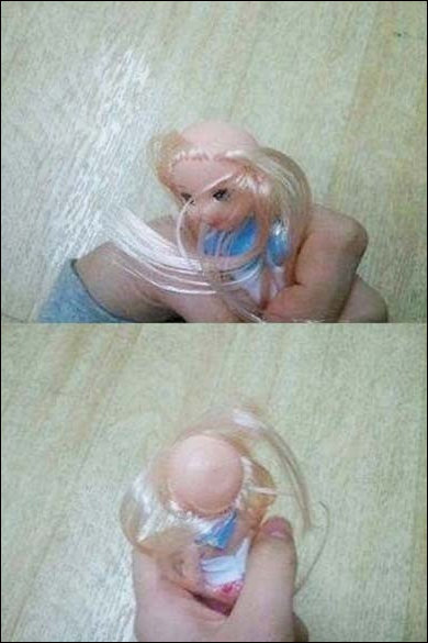 ‘탈모의 무서움’ 사진 화제