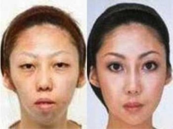 중국에서 한 여성(사진)이 성형수술을 숨기고 결혼했다가 남편과의 이혼소송에서 거액의 위자료를 물게 됐다.