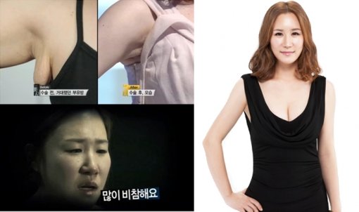 메이크오버에 성공한 송혜영 씨. 사진 ｜ 스토리온, 뷰성형외과