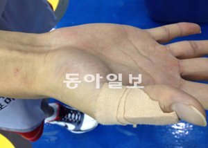 손가락을 다쳐 보호대를 착용한 SK 김선형의 오른손.