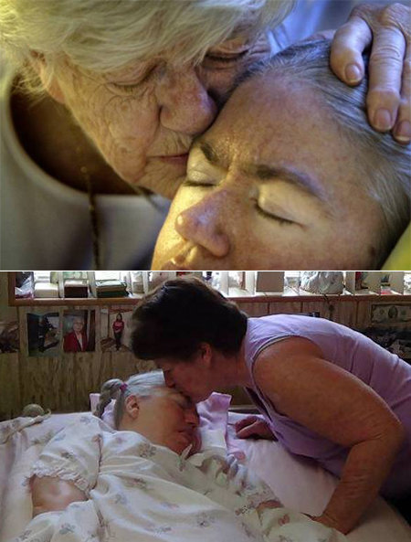 혼수상태로 누워있는 딸 에드워다의 얼굴에 어머니 케이 오바라 씨가 입을 맞추고 있다. 어머니와 딸 모두 어느덧 머리가 하얗게 세어 얼마나 오랜 세월 모녀가 병상에서 싸웠는지를 보여준다(위쪽). 어머니가 2008년 사망한 뒤에는 여동생 콜린 씨도 어머니 못지않게 언니를 보살펴 이들의 가족 사랑이 미국인들의 눈시울을 적시고 있다. 마이애미헤럴드 홈페이지