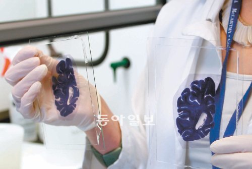 브라질 ‘브레인뱅크’에는 4000여 개의 인간 뇌조직이 보관돼 있다. 한 연구원이 뇌단백질을 분석하기 위해 수직으로 잘라 염색한 뇌조직을 들고 설명하고 있다. 상파울루=이영혜 채널A 기자 yhlee@donga.com