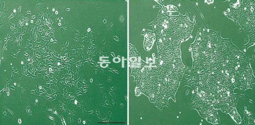 hnRNPA2/B1 단백질이 없는 줄기세포(왼쪽)는 정상적인 줄기세포(오른쪽)에 비해 세포 모양이 퍼져 있고 서로 떨어져 있다(사진 속 막대 길이는 100μm). 세종대 류춘제 교수 제공