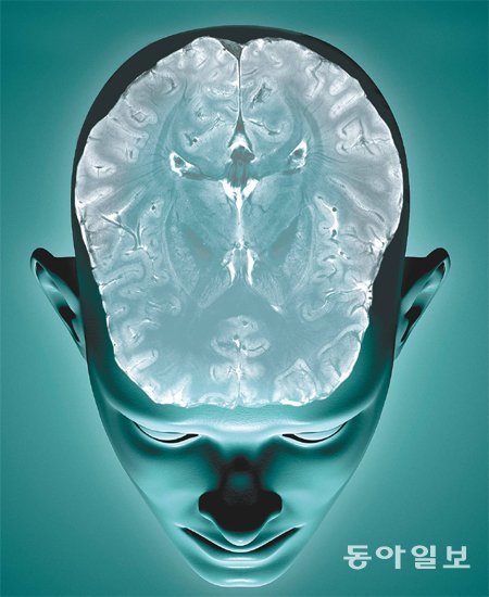 2009년 가천대 조장희 박사팀이 완성한 세계서 가장 선명한 뇌지도 이미지. 이 이미지는 7T MRI 장치로 찍은 뇌를 컴퓨터 이미지로 바꾼 것이다. 가천대 뇌과학연구소 제공