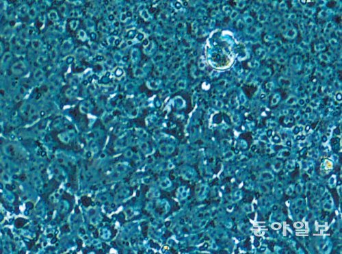 인간 배아줄기세포를 현미경으로 확대한 사진. 사진 윗부분에 배아줄기세포가 모여 있다. 연구팀은 체세포의 핵과 융합시킨 난자가 잘 분열하도록 커피에 많이 든 카페인을 넣어 성공률을 높였다. 셀(Cell) 제공