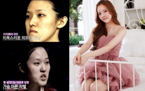 ‘렛미인’ 방송 캡처