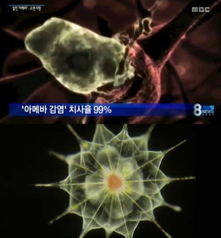 MBC 방송 화면