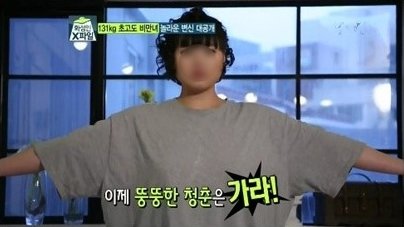 tvN '화성인 바이러스' 초고도 비만녀 사망