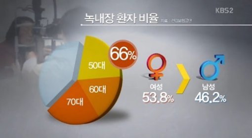 녹내장 환자 증가