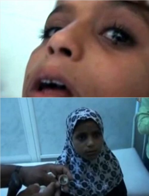 돌 눈물 흘리는 소녀
사진= 예멘 방송채널 아잘(Azal), 유튜브 화면 촬영