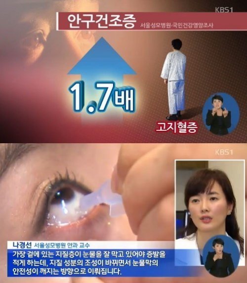 안구건조증의 원인 사진 출처 = KBS '9시 뉴스' 화면 촬영