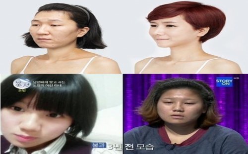 ‘렛미인’, 20대 할머니-노안녀, 스토리온 ‘렛미인4’ 화면 촬영