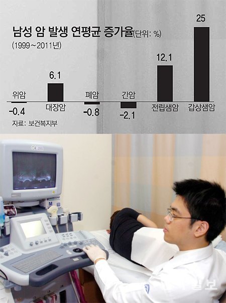 전립샘(전립선)암은 전립샘 세포에서 발생하는 악성 종양으로 초기 자각 증상이 거의 없어 뒤늦게 발견되는 경우가 많다. 사진은 항문을 통한 초음파검사로 전립샘암 진단을 받는 모습. 동아일보DB