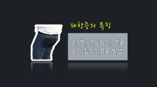 생활건강] 땀과의 전쟁, 다한증 : 2016년 제20회 국회의원 선거