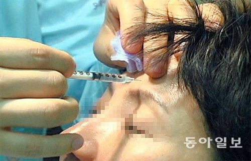 미간, 눈가, 턱 등에 보톨리눔을 반복적으로 시술하다보니 어느 시점이 되면 더 이상 효과가 뚜렷하게 나타나지 않는 ‘내성’이 발현될 수 있다. 전문가들은 시술 시 제품 성분과 양을 꼼꼼하게 따져야 한다고 지적한다. 동아일보DB