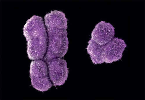 인간의 X 염색체(왼쪽)와 Y 염색체(오른쪽)의 실제 모습. 네이처