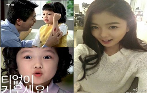 김유정 YG 바비. 사진 = 연고 CF 화면 촬영, 김유정 SNS