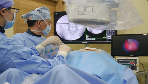 디스크 탈출증 환자에게 추간공내시경레이저술 장면.