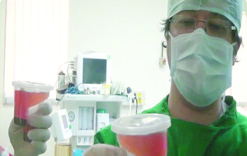 줄기세포 추출 및 농축 의료기기 스마트프렙-2를 개발한 미국 하버드대 의료진이 심근경색 환자에 투여할 골수줄기세포 농축액을 점검하고 있다. 미라 제공