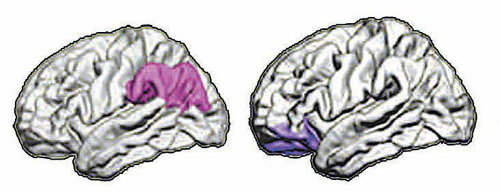 필로폰에 중독된 청소년의 뇌에서 성인 중독자보다 더 많은 손상이 나타난 영역. 왼쪽부터 두정엽과 전전두엽. 이화여대 뇌·인지과학과 제공