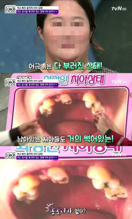 치통환자 증가(출처=tvN)