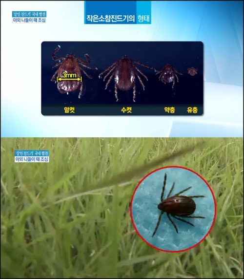 의료진 2차 감염