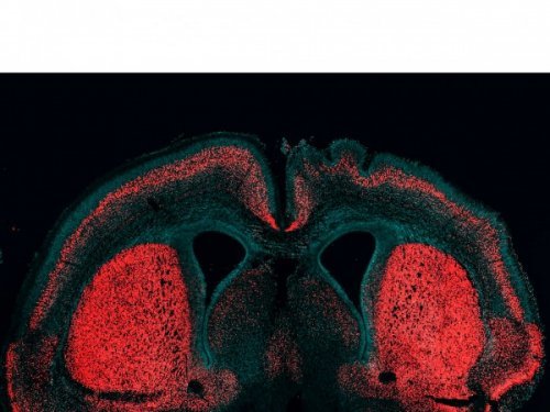 막스플랑크연구소가 뇌를 크게 만드는 유전자를 쥐에게 삽입한 결과, 유전자가 작동한 오른쪽 뇌가 그렇지 않은 왼쪽 뇌에 비해 커졌다. 왼쪽에는 없는 주름을 오른쪽에서 확인할 수 있다. 사진 제공 막스플랑크 연구소