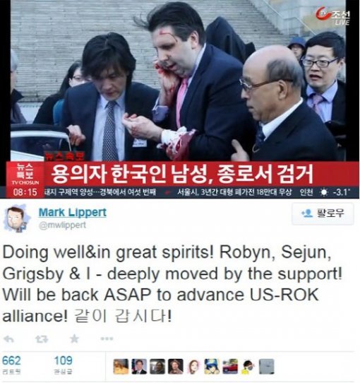 리퍼트 대사 수술 성공적. 사진= TV 조선 방송 갈무리, 리버트 트위터