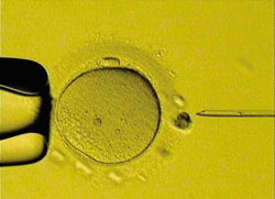 시험관 아기 수정을 위해 미세한 바늘로 난자(가운데 큰 원)에 정자를 넣는 모습.