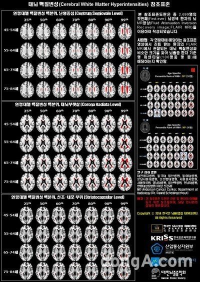 뇌경색 위험 예측지도(출처= 한국표준과학연구원)